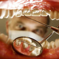 Do most people go to the dentist regularly?