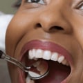 How important are dental visits?
