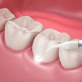 Can i get tooth lengthening using a cosmetic dental procedure?