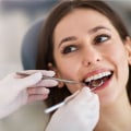 What does a normal dental check up include?