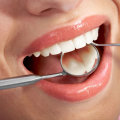 What are basic dental procedures?