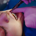 Is it normal to not go to the dentist for 10 years?