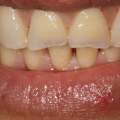 What is the official name for a cosmetic dentist?