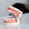 What happens if you don't go to the dentist for 10 years?