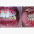 How long does a full dental exam take?