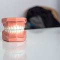 What is the best quality of artificial teeth?