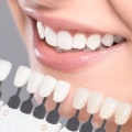 What is a cosmetic dentist?
