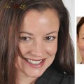 Can dentist add length to teeth?