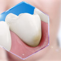 Are there any treatments available for sensitive teeth or gums?