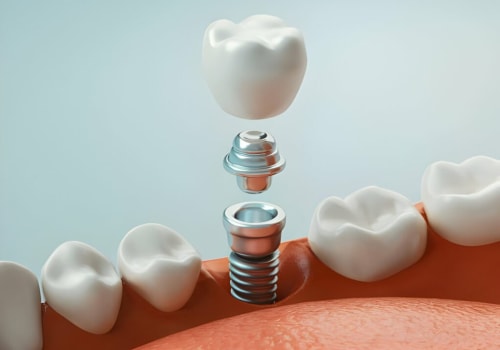 What's the most painful dental procedure?
