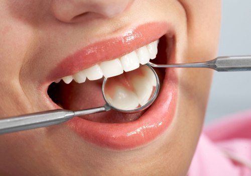 What are basic dental procedures?