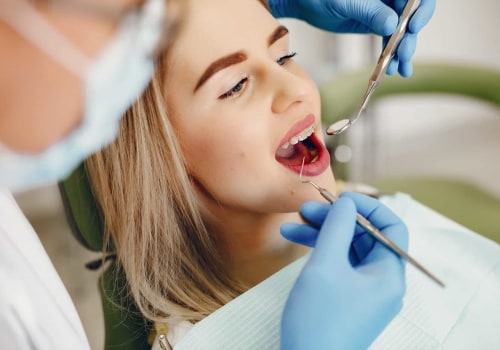 Do you need to go to the dentist every 6 months?