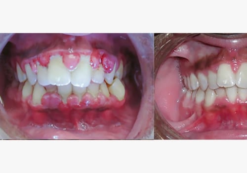 How long does a full dental exam take?