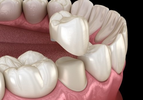 Is it painful to get a crown?